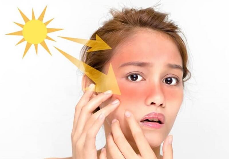 Dùng sai loại kem chống nắng là yếu tố hàng đầu gây ra ung thư da