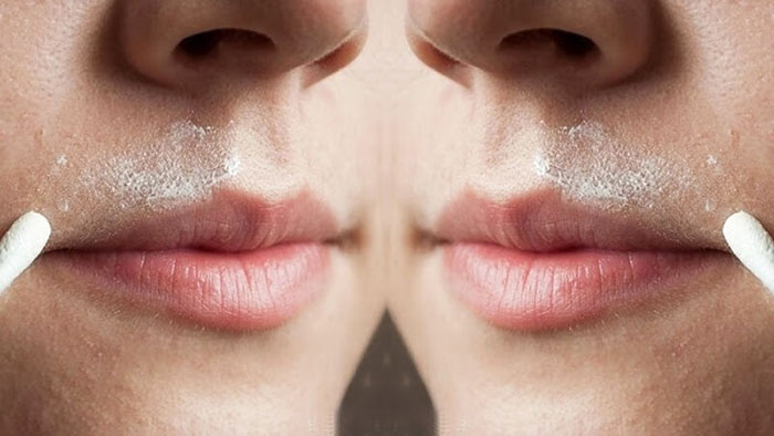 Dùng kem thuốc trị thâm ở mép môi